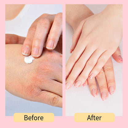 Luxurious Hand Cream – Deep Moisturizing, Fast-Absorbing, Natural Ingredients – Soft, Hydrated Hands All Day
